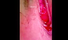 学校舞蹈教室旁女厕偷拍贴冒死逼拍摄小妹妹好像来月经了，小穴红红彤彤