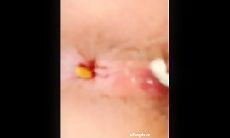 女厕怼逼偷拍写字楼贴B拍一个小骚逼少妇被发现，赶紧溜
